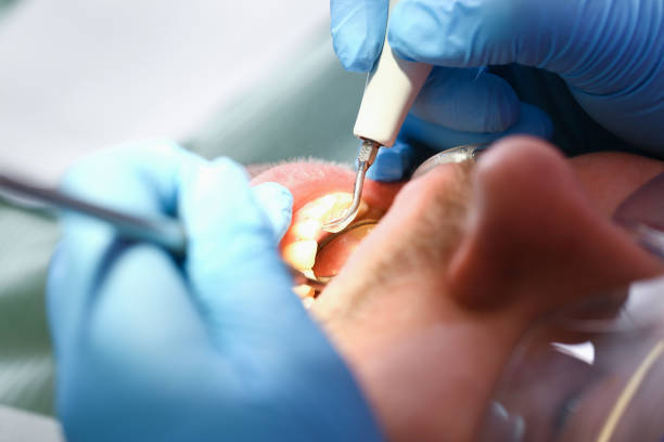 Best Emergency Gum Treatment in Granville, OH