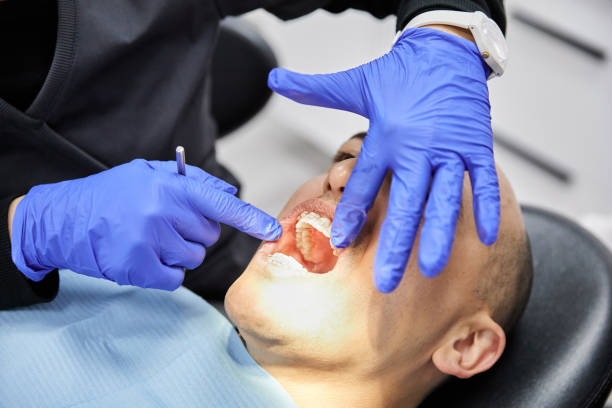 Best Emergency Denture Repair in Granville, OH